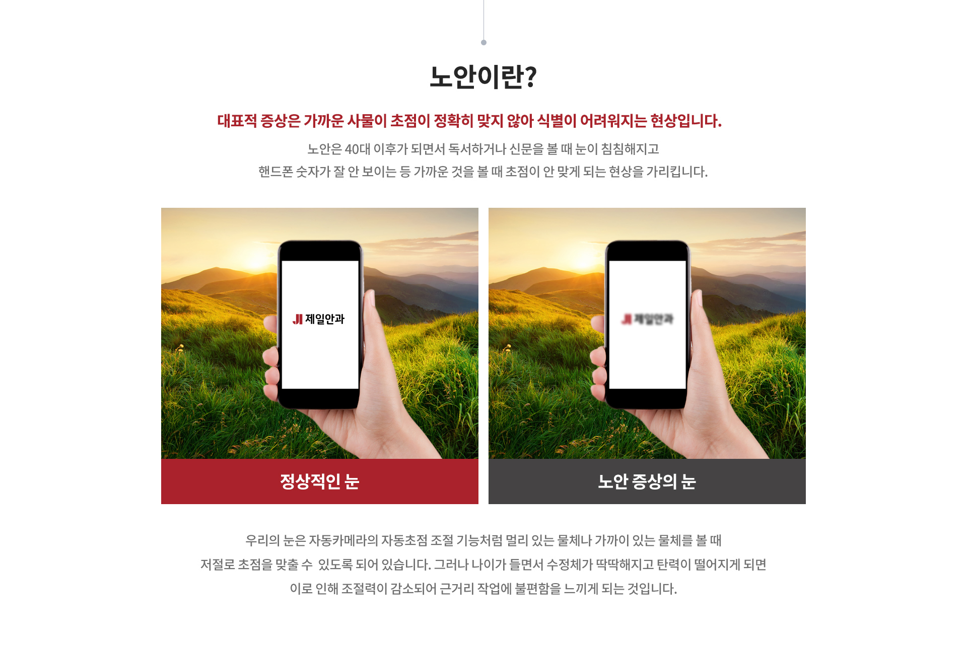 노안클리닉